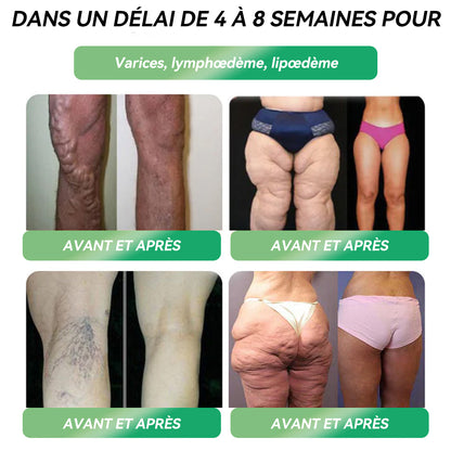 30 % DE RÉDUCTION 🎁🎁𝗟𝗢𝐓𝗠𝗔𝐘® 𝑮𝙇𝑷-1 𝙈𝙪𝙡𝙩𝙞-𝘼𝒄𝙩𝙞𝙤𝒏 𝙊𝙧𝙖𝙡 𝑨𝙢𝙥𝒐𝙪𝙡𝙚𝒔